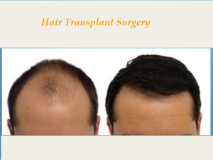 hair transplant Islamabad