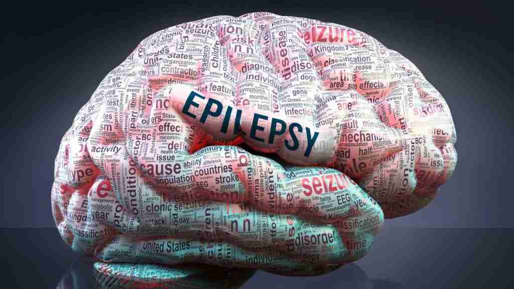 Conquering Convulsions: Overcoming Epilepsy Challenges