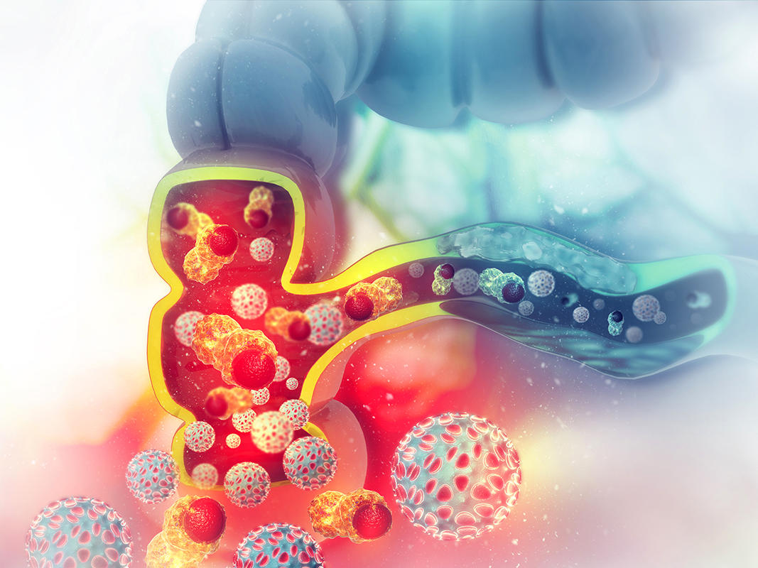 Encorafenib Market Latest Trends and Analysis, Future Growth