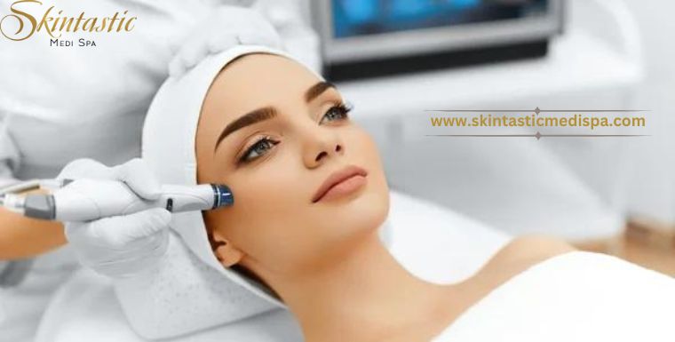 Transform Your Skin with Photofacial IPL in Riverside