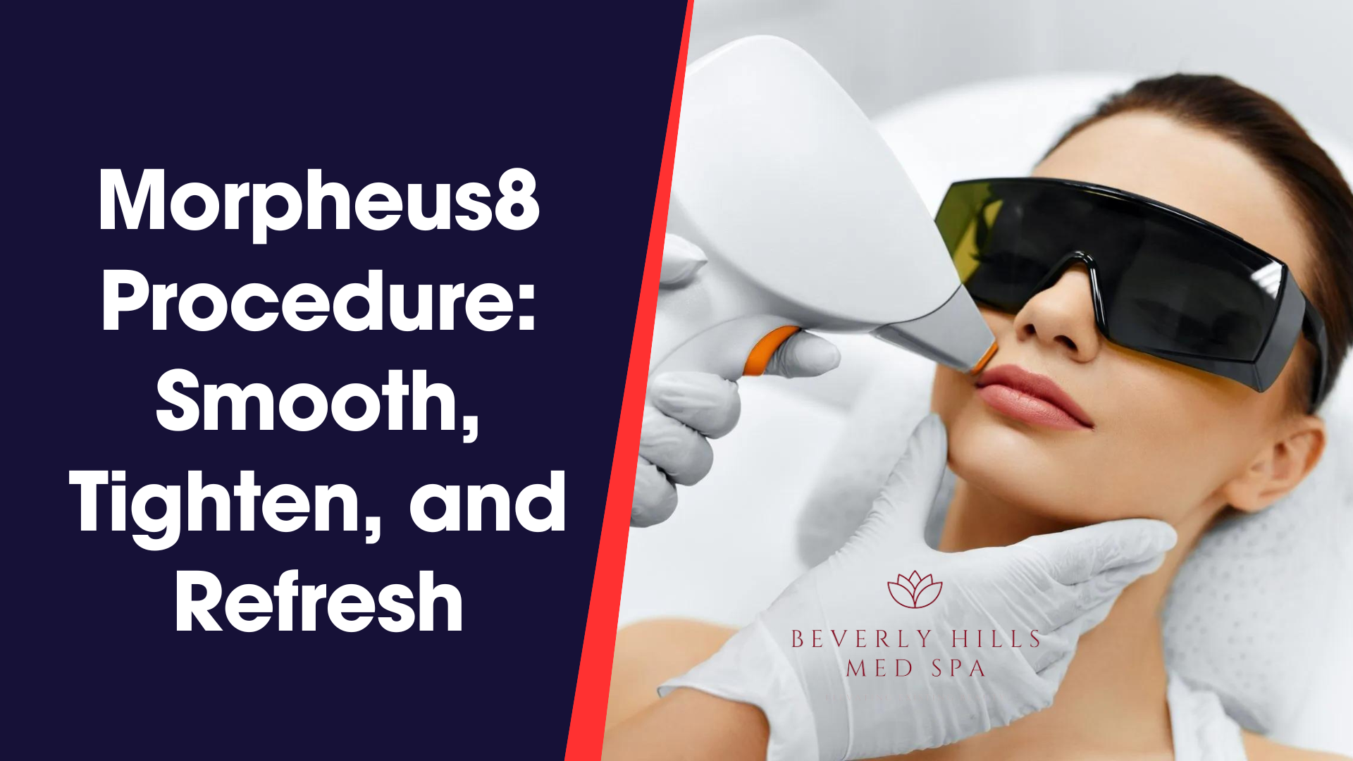 Morpheus8 Procedure: Smooth, Tighten, and Refresh