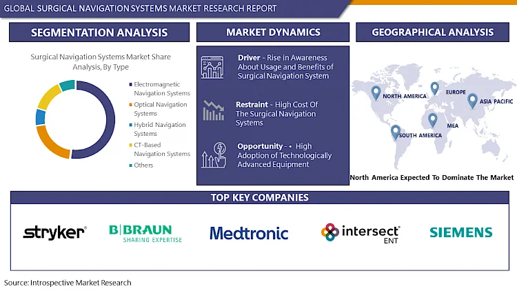 Surgical Navigation Systems Market Latest Innovations, Drive