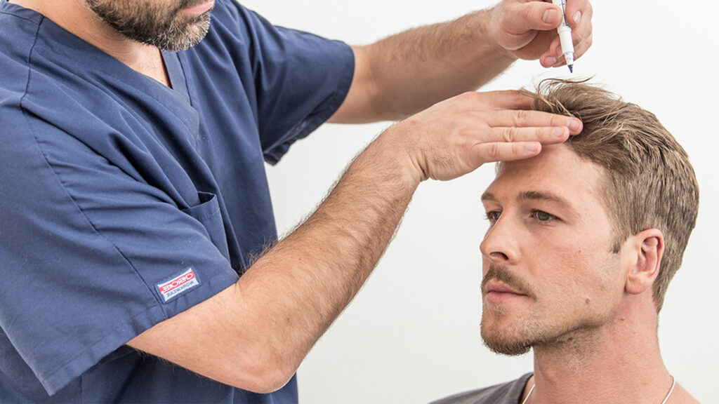 Hair Transplants in Riyadh: A Step-by-Step Overview of the P