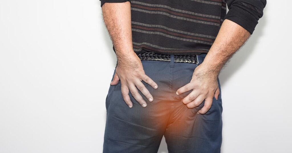 Addressing Common Concerns About Hemorrhoids Treatment