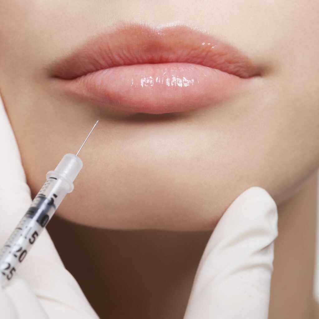 Long-Lasting Lip Filler Injections in Dubai