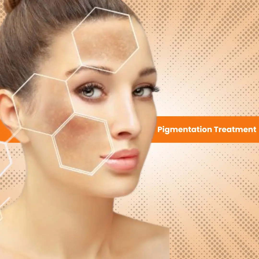 The Ultimate Guide to Pigmentation Treatment Kit