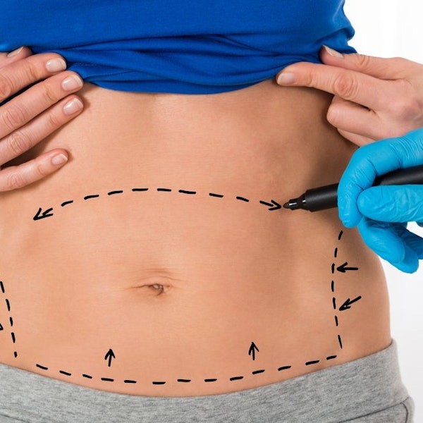 Mini Abdominoplasty and Post-Surgical Support in Dubai