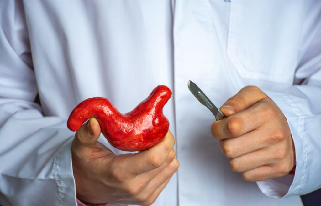 The Complete Guide to Bariatric Surgery in Islamabad for a H