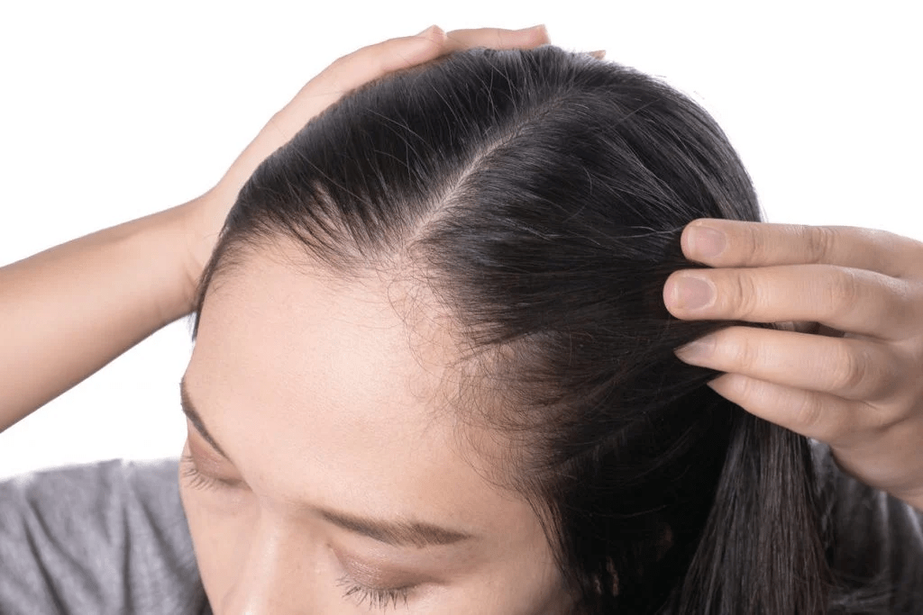How Does Finasteride Compare to Dutasteride?