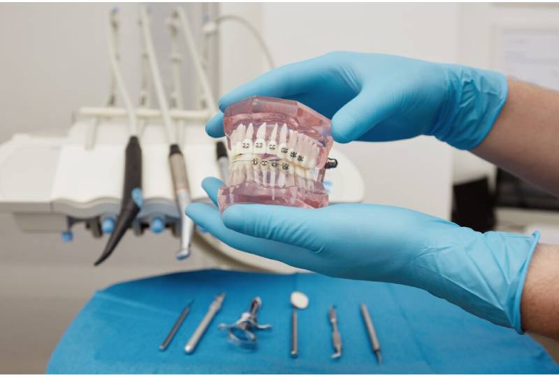 Why Choose All-on-4 Dental Implants? Insights from Pembroke Pines Experts