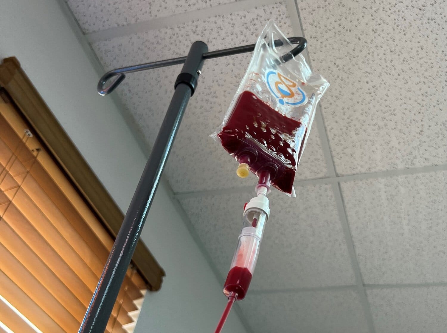 Ozone Therapy for Arthritis Can It Ease Joint Pain