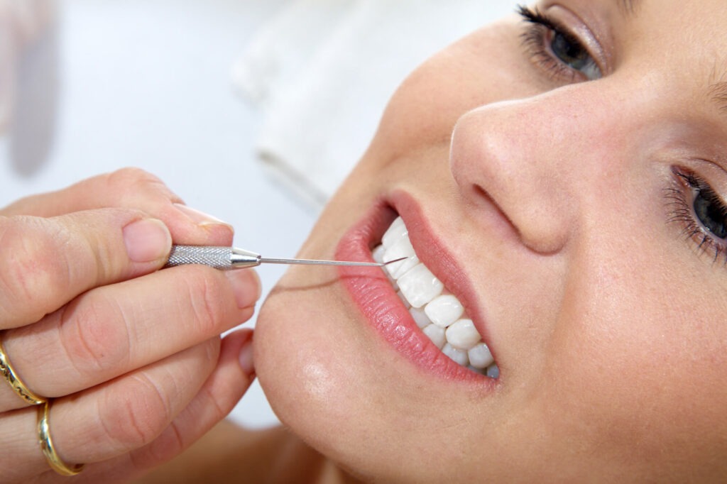 Teeth Cleaning for Braces Wearers: Special Considerations