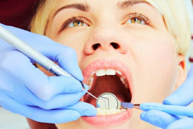 What Can You Expect From Teeth Whitening in Mississauga?