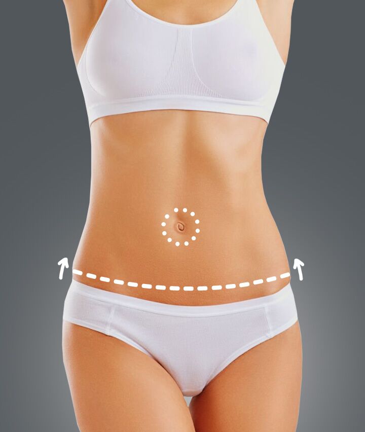 Can I Undergo a Tummy Tuck in Dubai if I Have Skin Condition