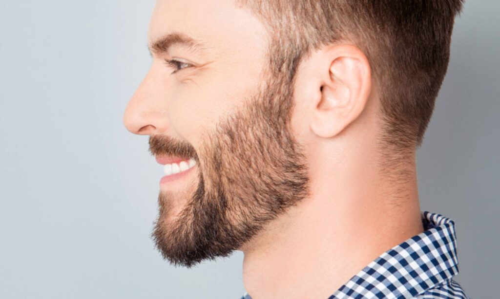 How Beard Hair Transplants Are Redefining Male Grooming
