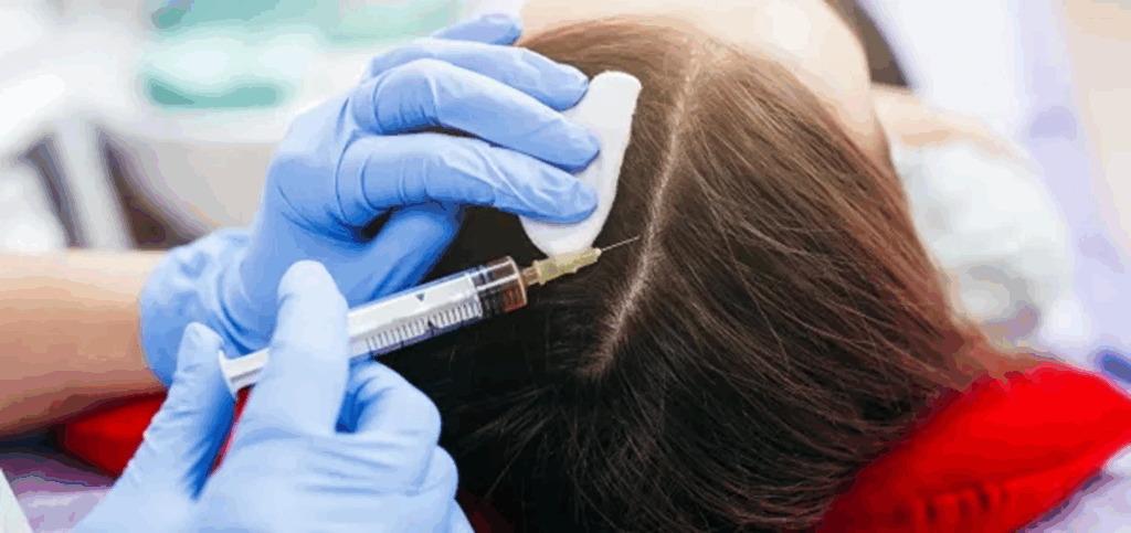 How PRP Hair Treatment Stimulates Hair Growth at the Follicl