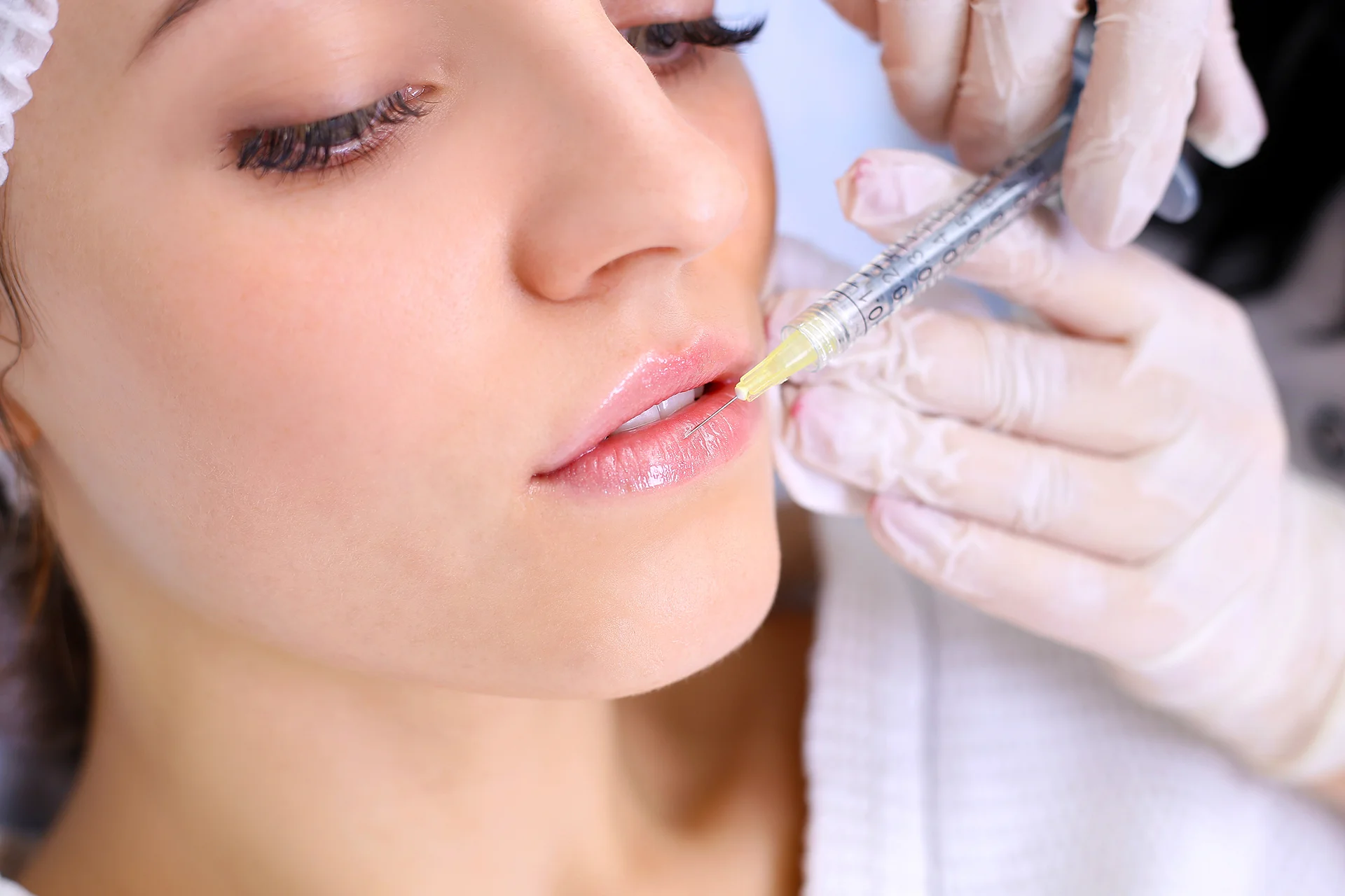 Is Lip Fillers Injections a Long-Term Solution?