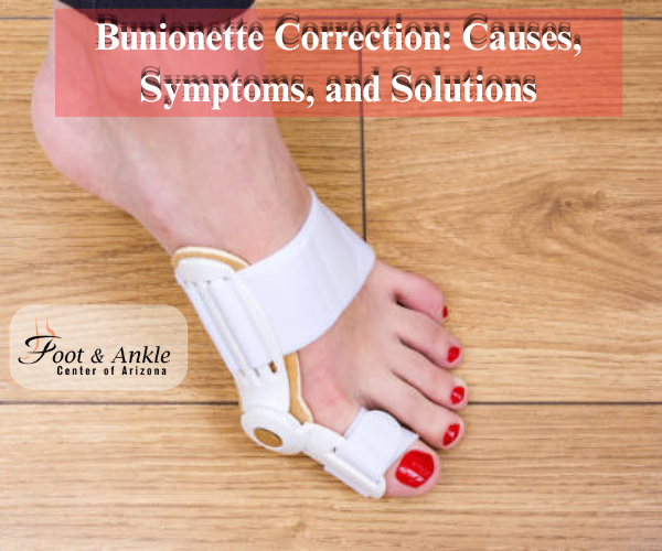 Bunionette Correction: Causes, Symptoms, and Solutions