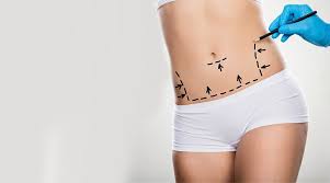 Can I Get a Tummy Tuck in Dubai If I Have a History of Diabe