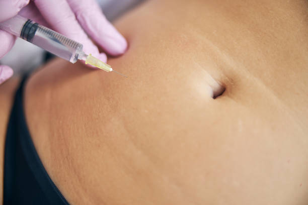 Fat Dissolving Injections in Dubai