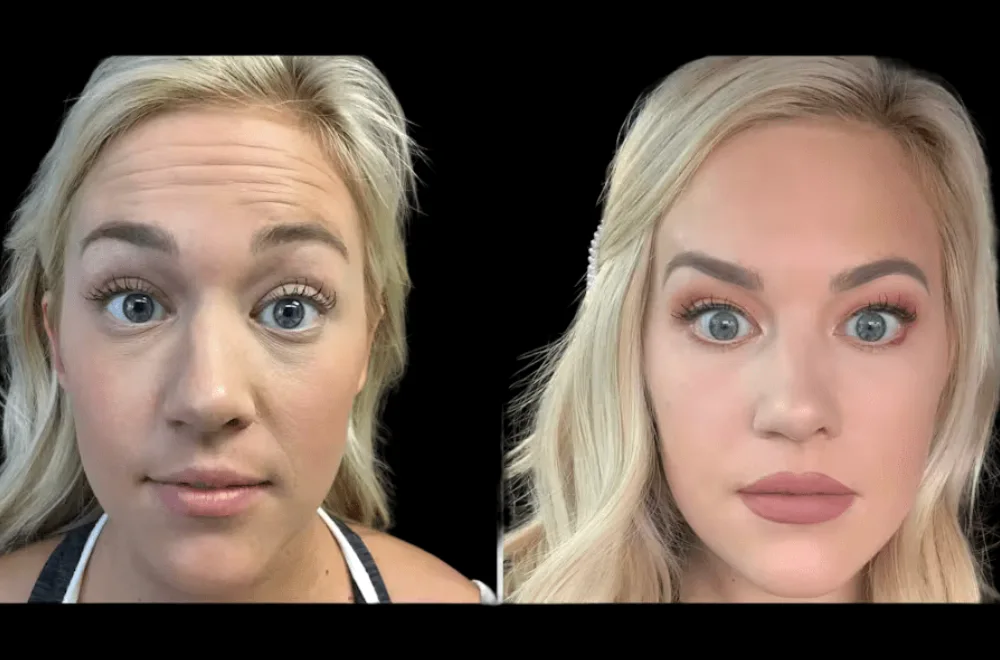 Why Celebrities Trust the Best Plastic Surgeon in dubai for Botox