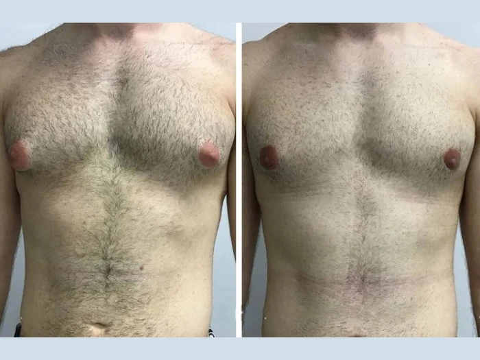 New PostMeet the Best Doctors in Dubai Specializing in Male