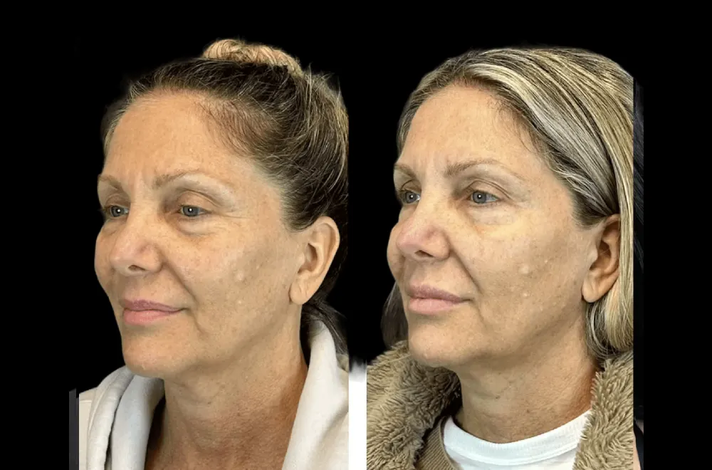 Luxury Meets Expertise at the Best Aesthetic Clinic in Dubai