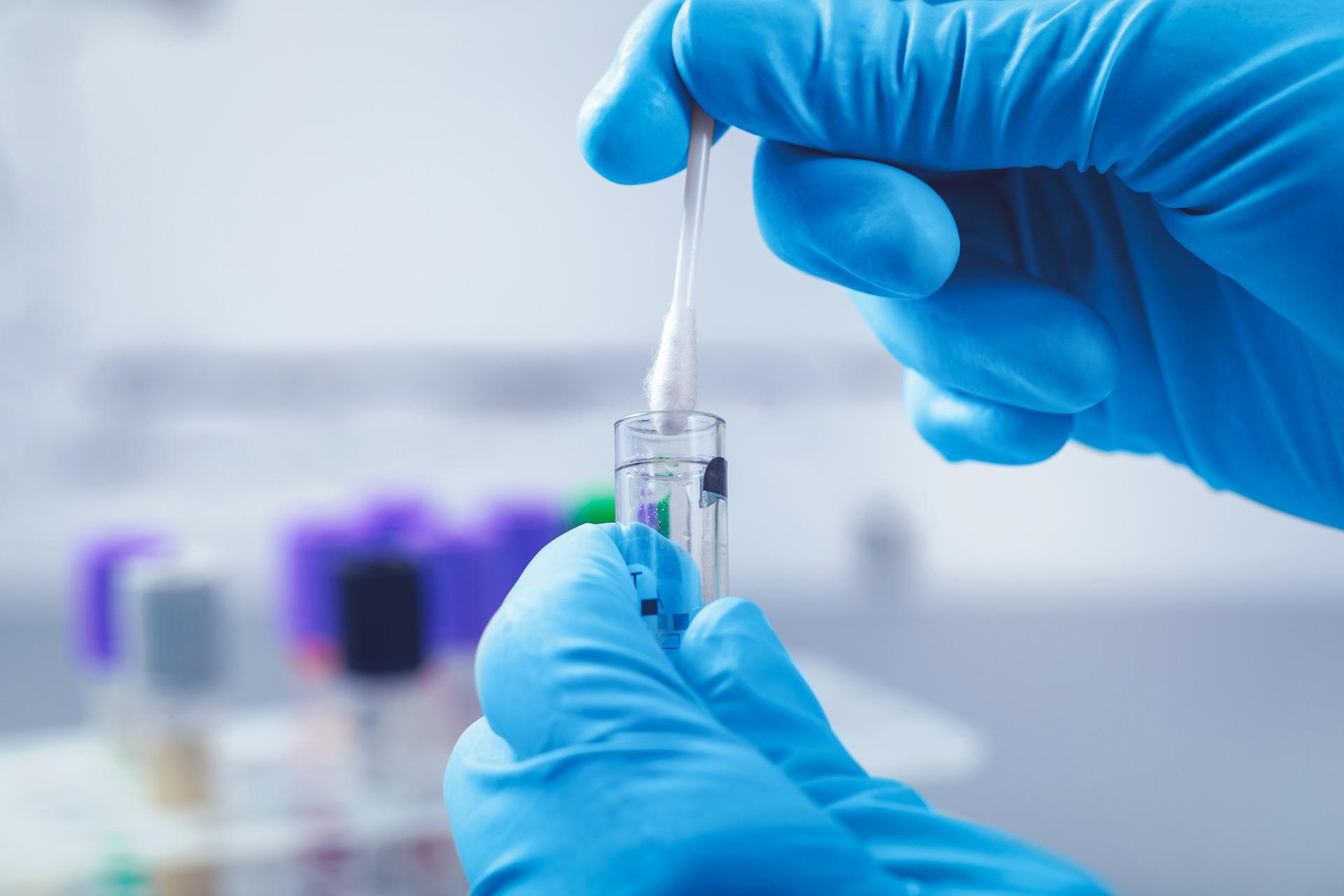 How Accurate Are Sibling DNA Tests?When it comes to determin