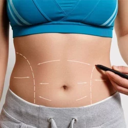 How Do I Deal with Food Cravings After Bariatric Surgery in