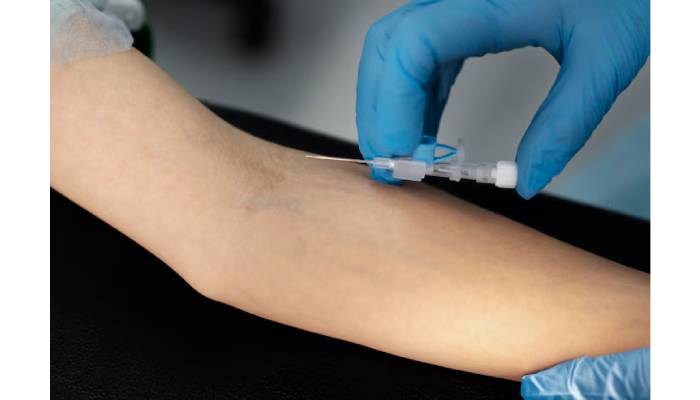 How to Maximize Your Energy with IV Therapy?