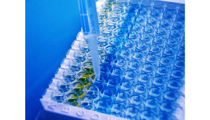 Advancements in Laboratory Automation and Their Impact on Assay Development