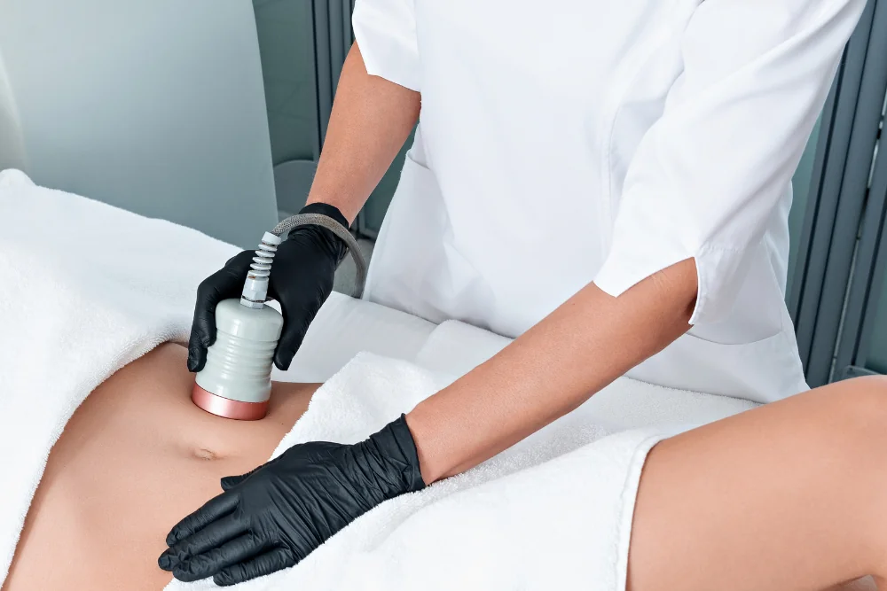 What Is Laser Liposuction and How Does It Work?