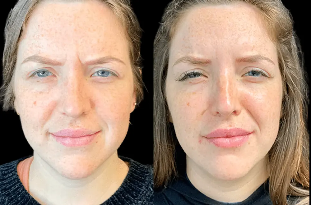 Celebrity-Approved Treatments at the Best Aesthetic Clinic in Dubai
